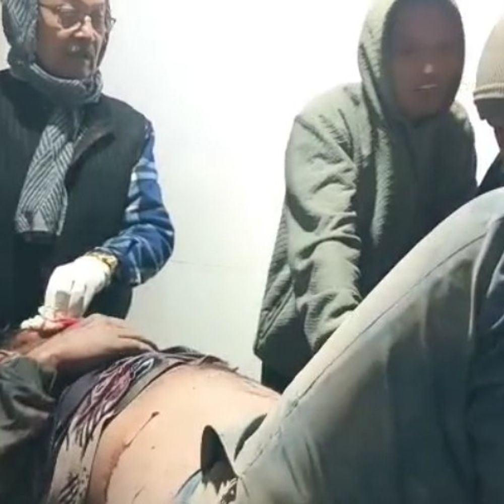 नवादा में युवक पर चाकू से हमला:  तीन हमलावरों ने ईंट-पत्थर से सिर फोड़ा, फैमिली मेगा मार्ट के पास हुई घटना – Nawada News