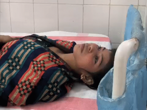 भागलपुर में बॉयफ्रेंड ने गर्लफ्रेंड को चलती ट्रेन से फेंका:सिर-कमर में चोट; पीड़िता बोली- शादी के लिए दिल्ली ले गया था, वहां भी धोखा मिला