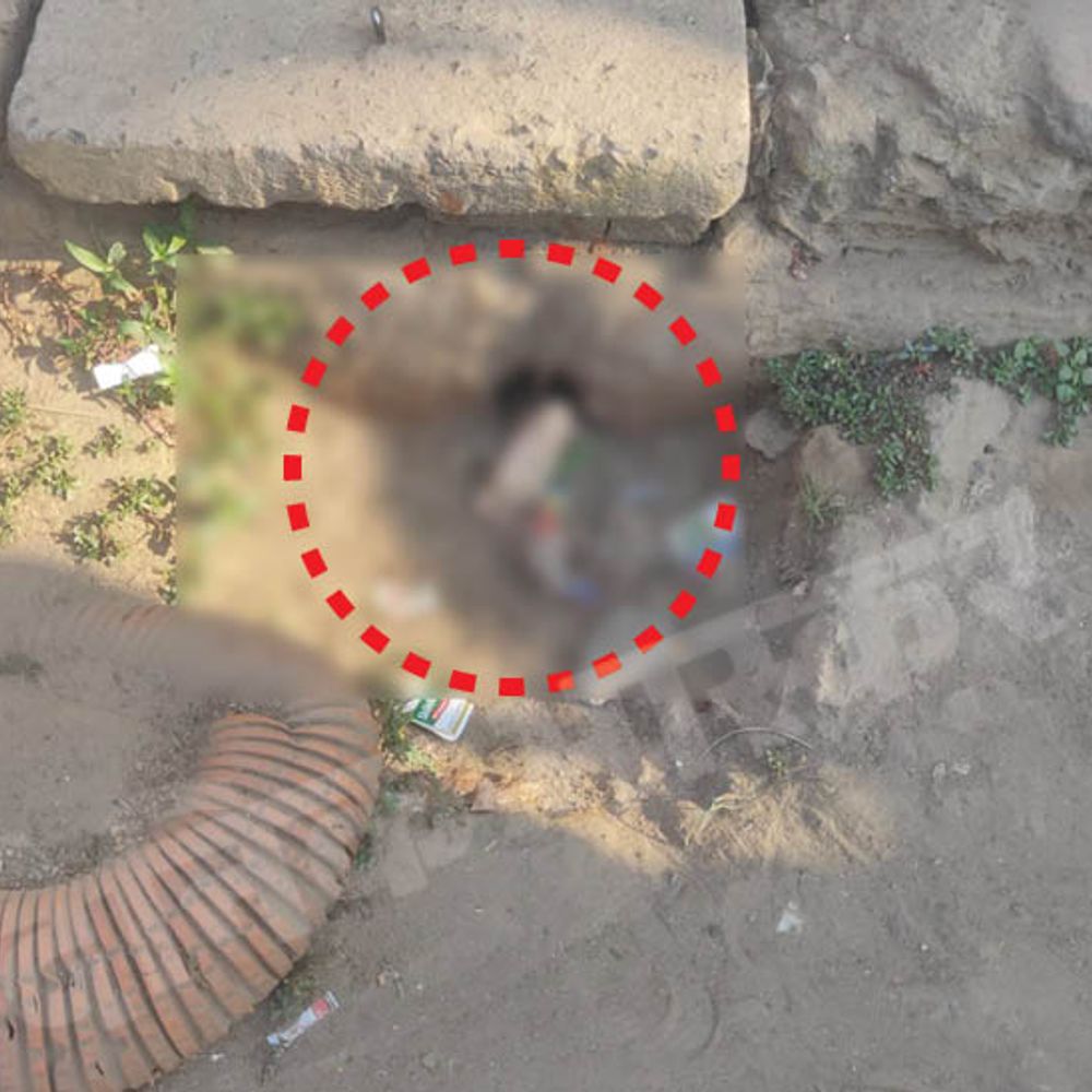 पटना में मिला बच्चे का कटा हुआ पैर:कुत्ते नोचकर खा रहे थे; PMCH में रखा गया पैर, बॉडी के लिए सर्च ऑपरेशन चल रहा