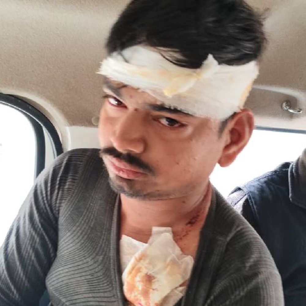 गयाजी में जमीनी विवाद में चली गोलियां:जोड़ा मस्जिद इलाके में कई राउंड हुई फायरिंग; दो लोग घायल, पुलिस ने मौके से बरामद किए खोखा