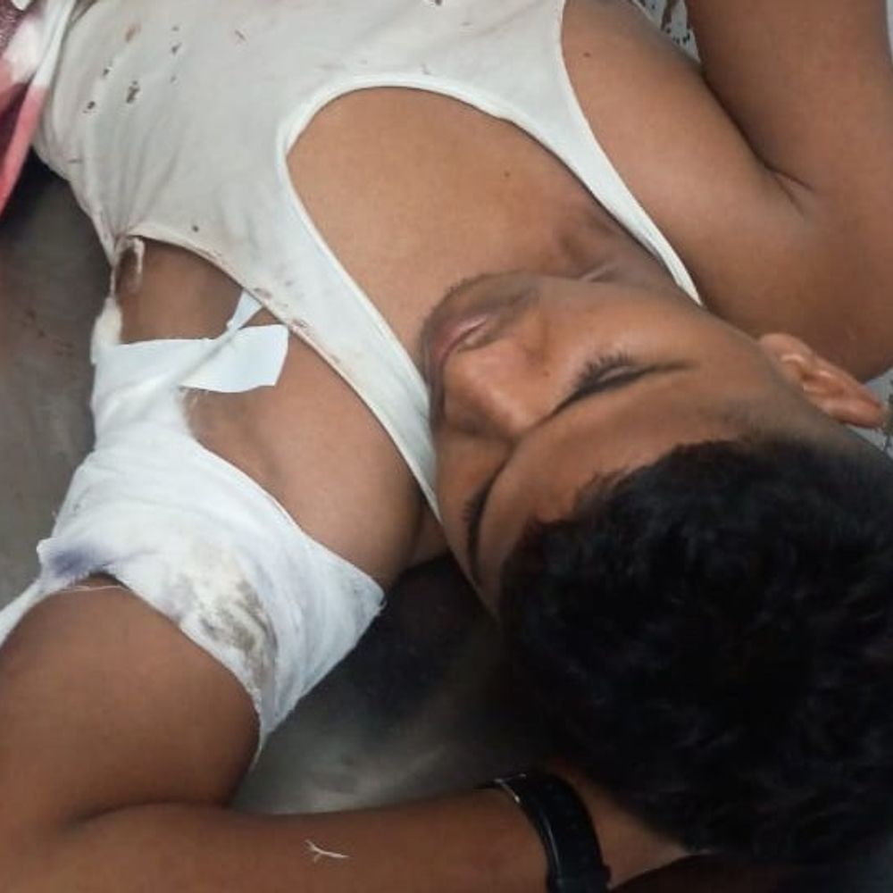 देवरिया में युवक पर चाकू से हमला:हालत नाजुक, गोरखपुर मेडिकल कॉलेज रेफर