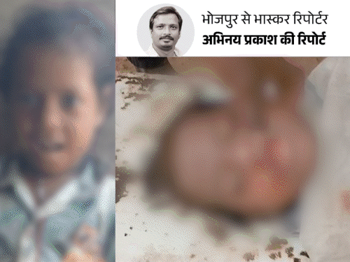 5 साल की बच्ची की रेप-हत्या, पढ़िए पोस्टमॉर्टम रिपोर्ट:चेहरे पर खरोंचा, प्राइवेट पार्ट डैमेज; डॉक्टर बोले- ऐसी दरिंदगी पहले कभी नहीं देखी