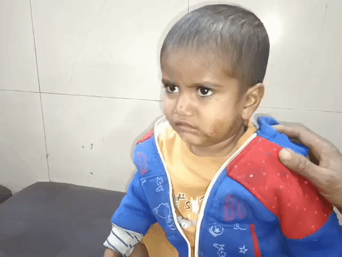 बहराइच में भेड़िए ने मासूम पर किया हमला:परिजनों के दौड़ाने पर बची जान, पिता ने कहा- लंगड़ा था भेड़िया