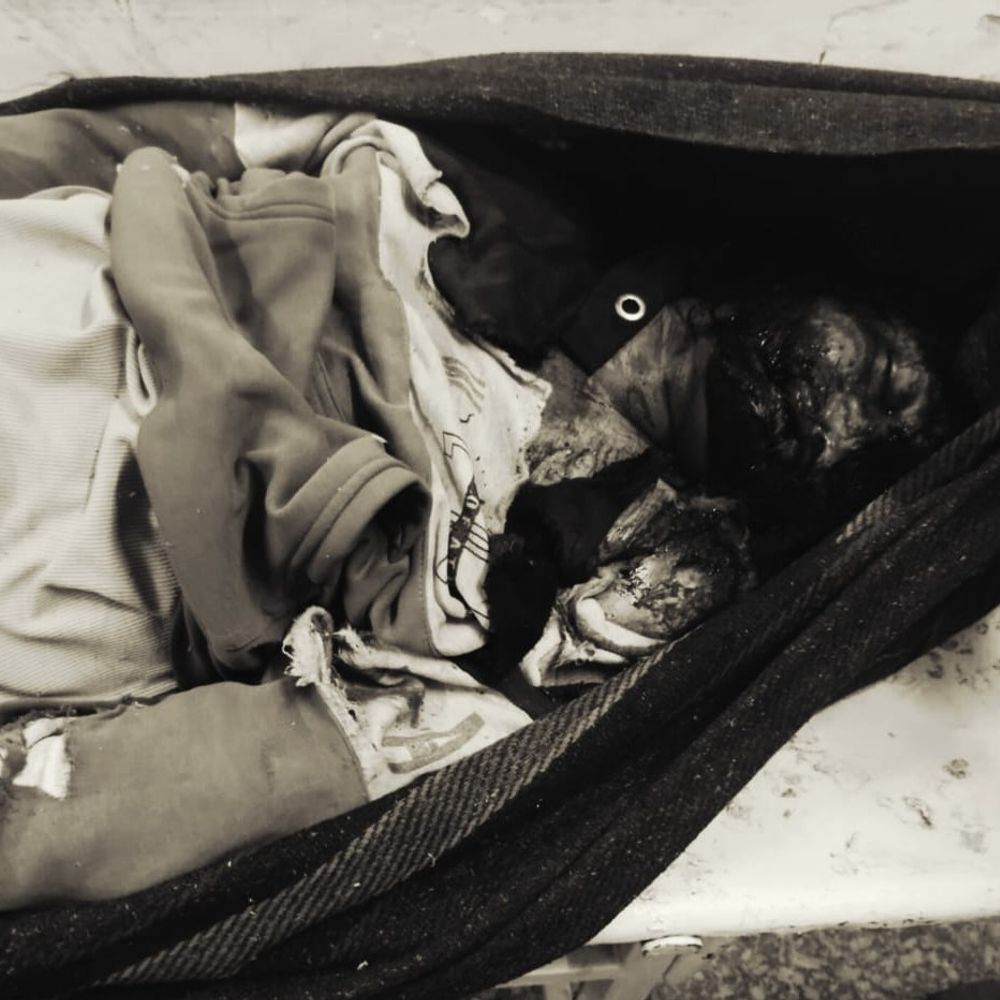 आगरा में एक्टिवा सवार दो युवकों को ट्रक ने रौंदा:एक की मौत, ट्रक ड्राइवर मौके से फरार,पुलिस जांच में जुटी