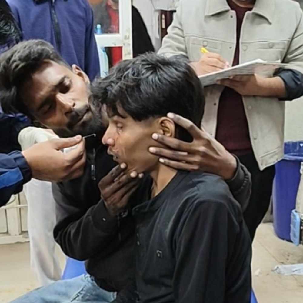 हाथरस में आतिशबाजी से दो किशोर झुलसे:एक कार्यक्रम के दौरान हादसा, एक की आंख में बारूद लगा, हालत गंभीर