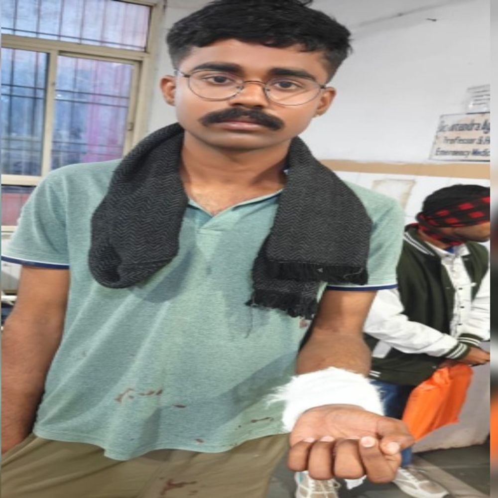 किराना शॉप पर सामान लेने आए युवक को लगी गोली...घायल:पास में चल रहे झगड़े से फायर की आशंका, CCTV खंगाल रही पुलिस