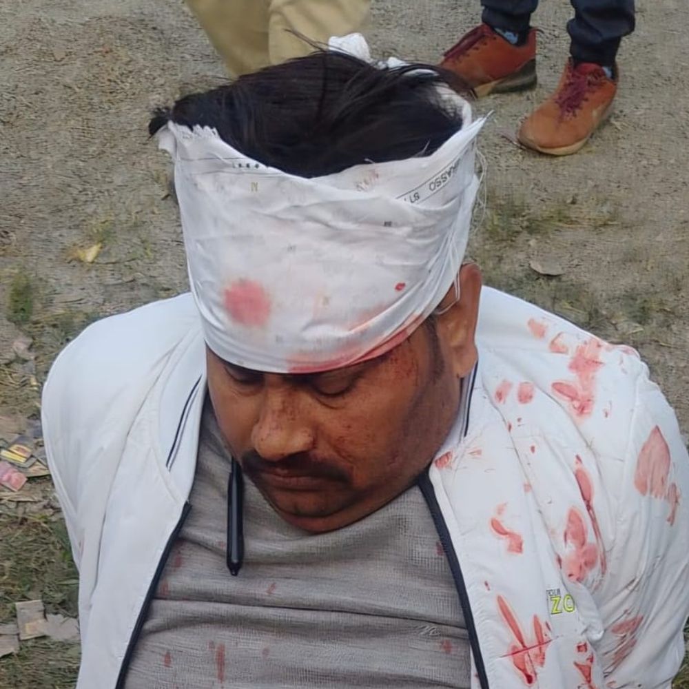 कानपुर में कार रोड रोलर से टकराई:सिपाही अभिषेक कुमार गंभीर घायल, मैनपुरी जा रहे थे