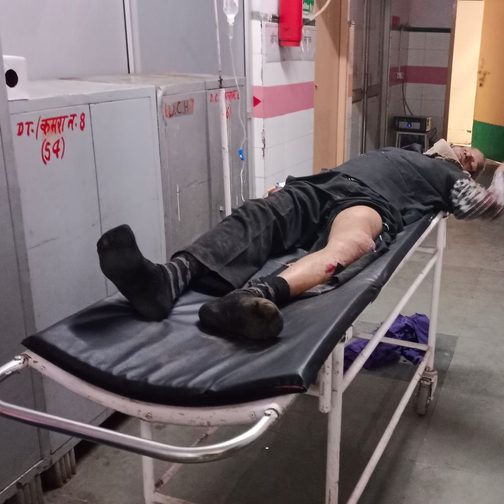 सम्भल में दो बाइकों की आमने-सामने टक्कर:दो लोग गंभीर घायल, एक चालक मौके से फरार