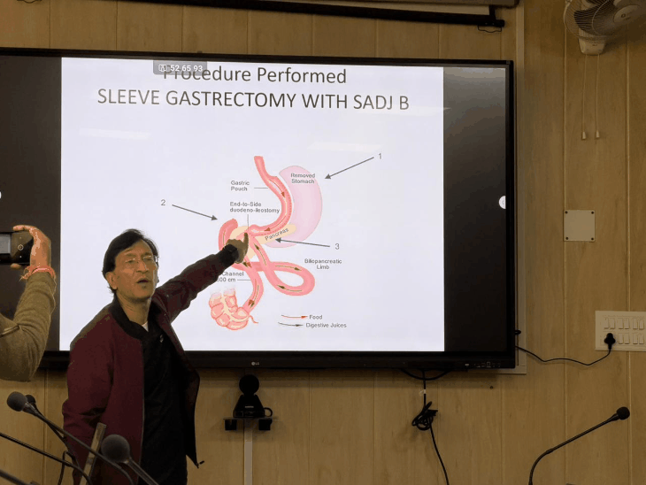 कानपुर में पहली बार हुई हाइटेक बेरिएट्रिक सर्जरी:6 महीने में कम होगा 40 किलो वजन, GSVM मेडिकल कॉलेज में 6 घंटे तक चली सर्जरी