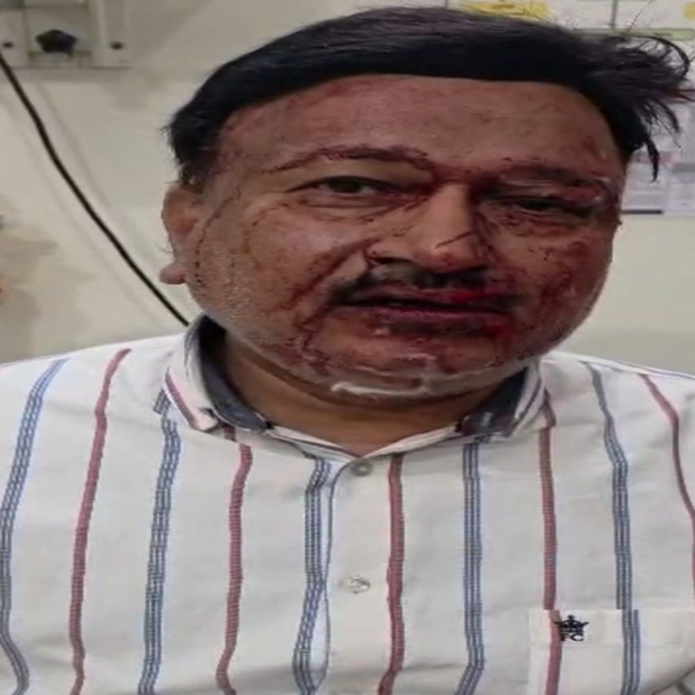 अंबिकापुर में व्यवसायी से 20 लाख रुपए की लूट:बदमाशों ने घर लौटने के दौरान हमला, रुपयों से भरा बैग लेकर भाग निकले,संदिग्ध हिरासत में