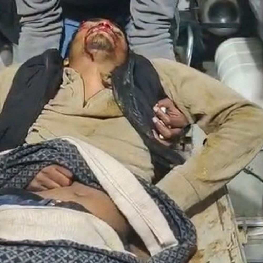 कुशीनगर में सड़क हादसा, तीन युवक गंभीर घायल:नया साल मनाकर लौट रहे थे, पनियहवा रोड पर बाइक दुर्घटनाग्रस्त हुई