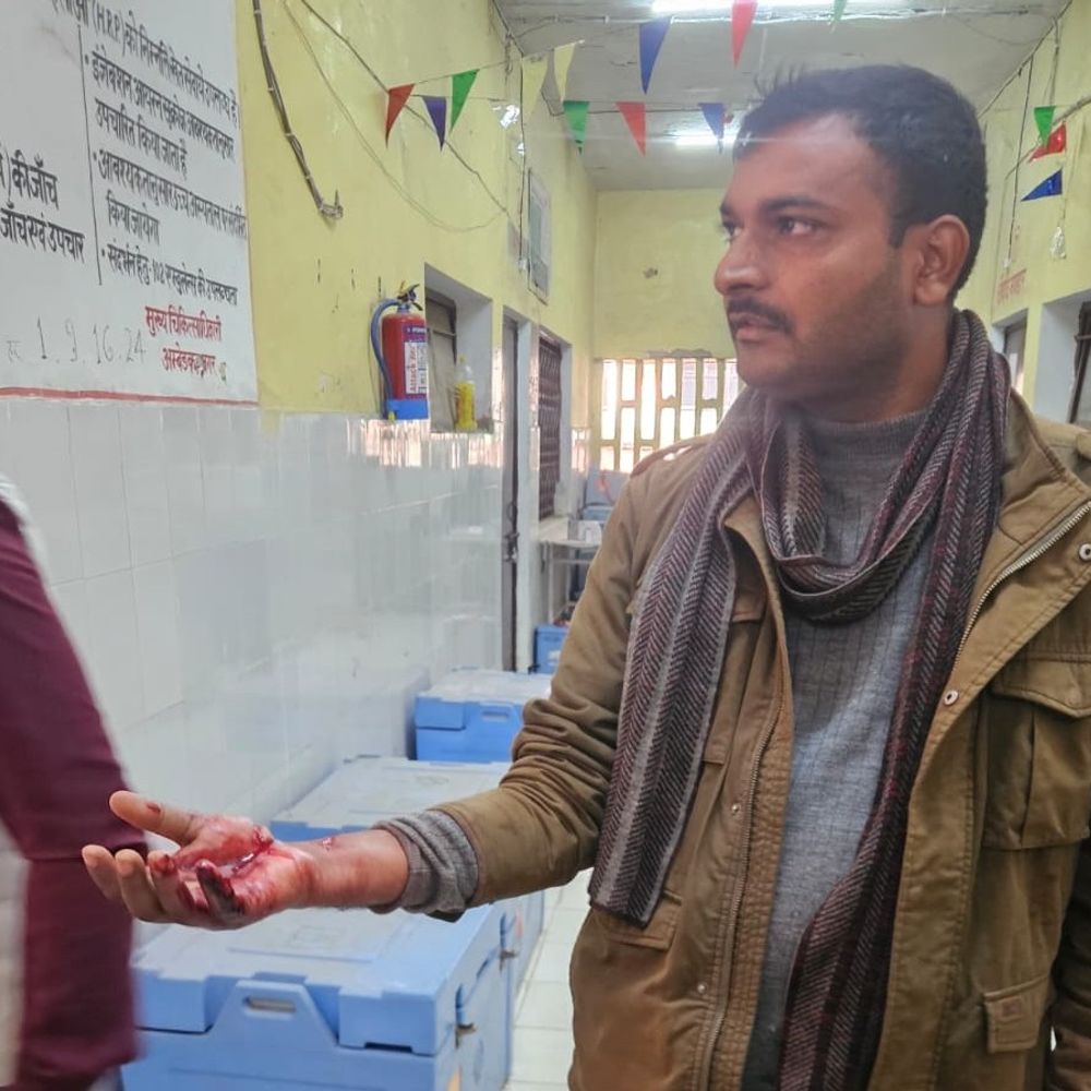 छुट्टी पर आए सिपाही पर हमला:अंबेडकरनगर में जमीनी विवाद को लेकर दबंगों ने पीटा, बहन भी घायल