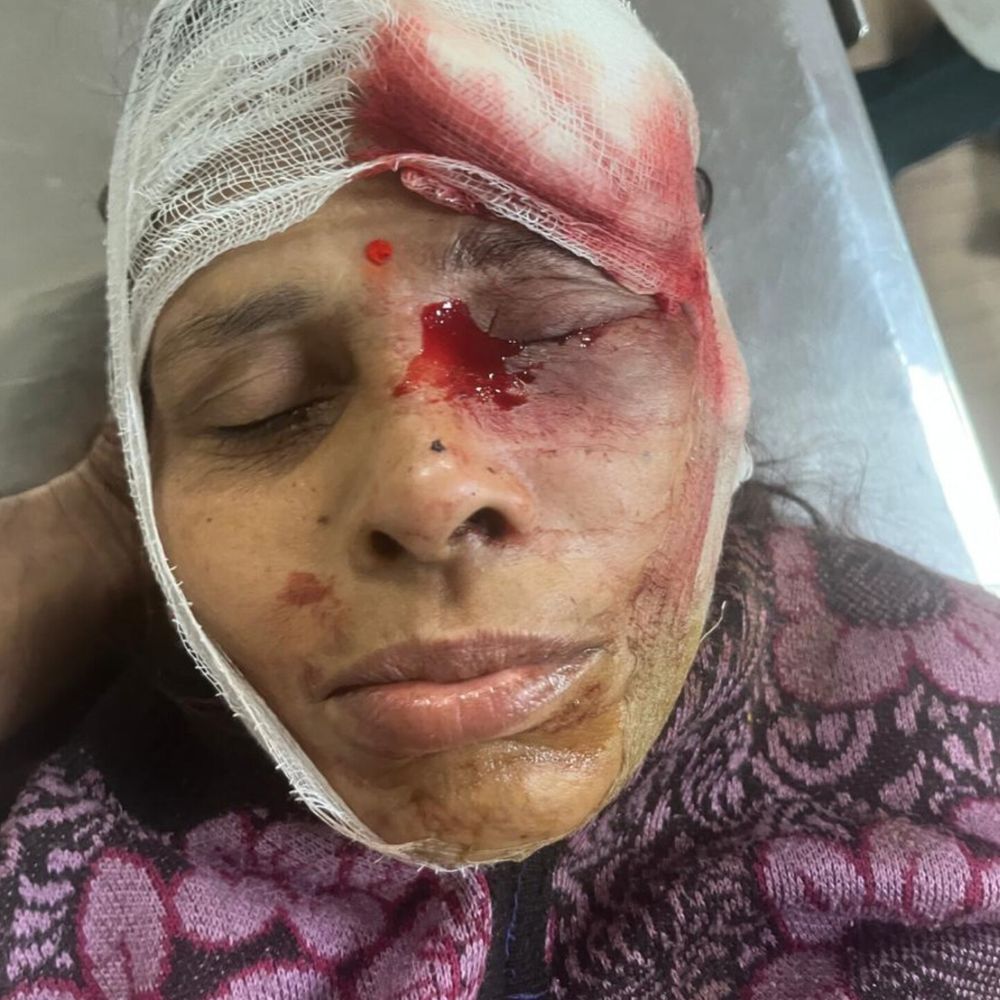 बुलेट से आवाज निकालने पर दो पक्ष भिड़े:जमकर चले लाठी डंडे, महिला सहित दो लोग घायल