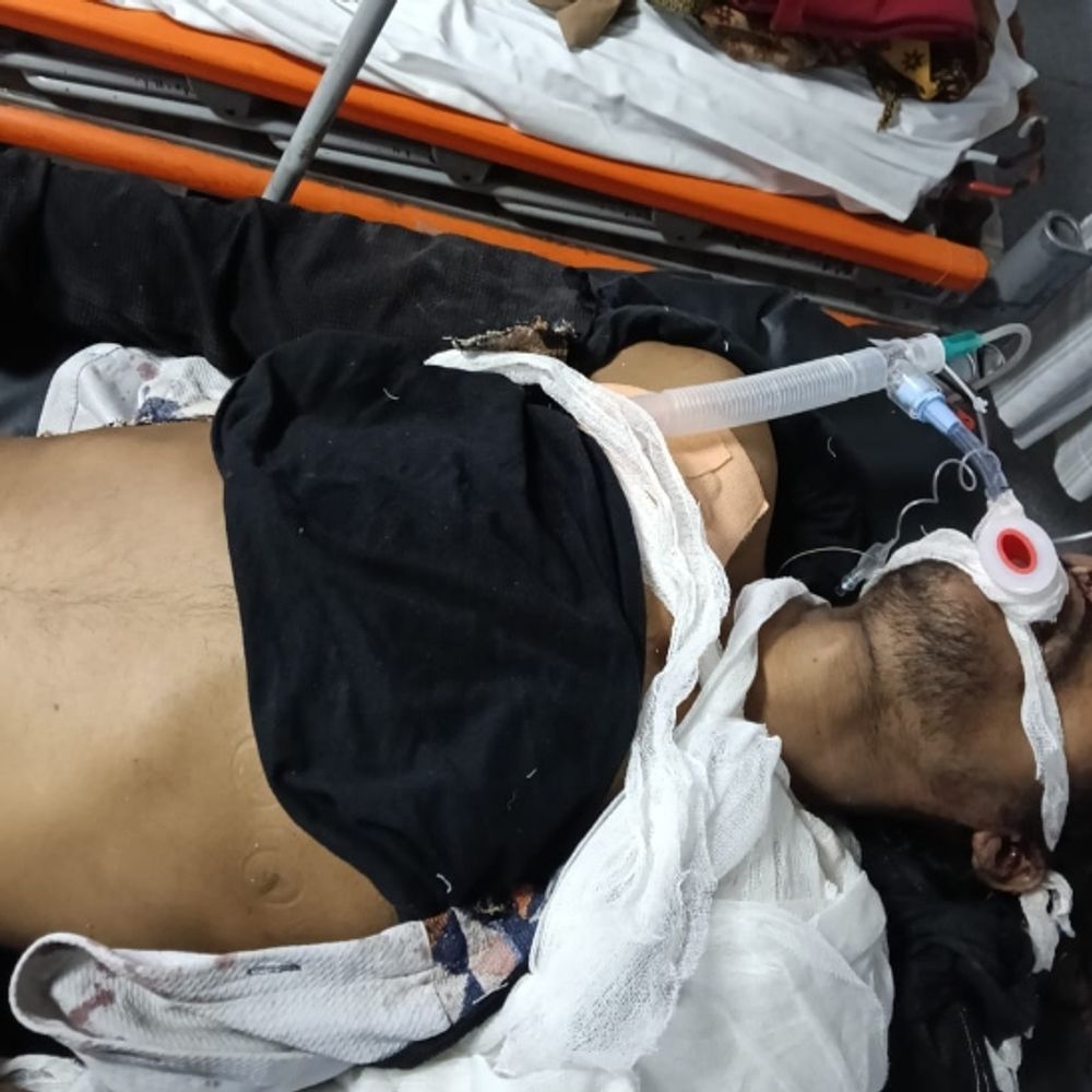 रायपुर में ई-रिक्शा टक्कर से युवक की मौत:  परिजनों का अस्पताल में हंगामा, शव लेने से इनकार, कहा- हादसा नहीं, हत्या है; कार्रवाई की मांग – Raipur News