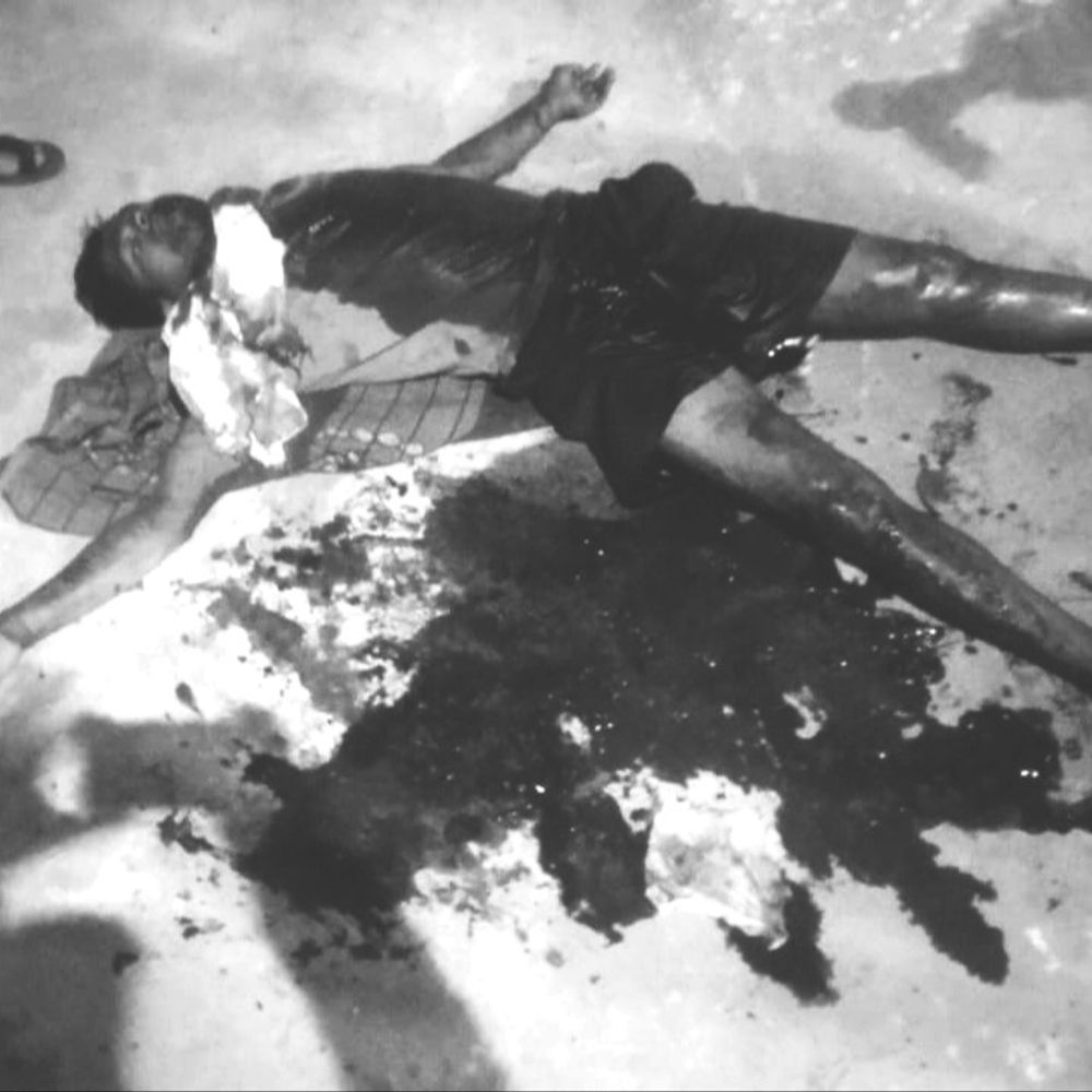 फांसी लगाई तो रस्सी टूटी, फिर मशीन से काटा गला:छिंदवाड़ा में युवक ने दो बार की सुसाइड की कोशिश, नागपुर में आईसीयू में भर्ती