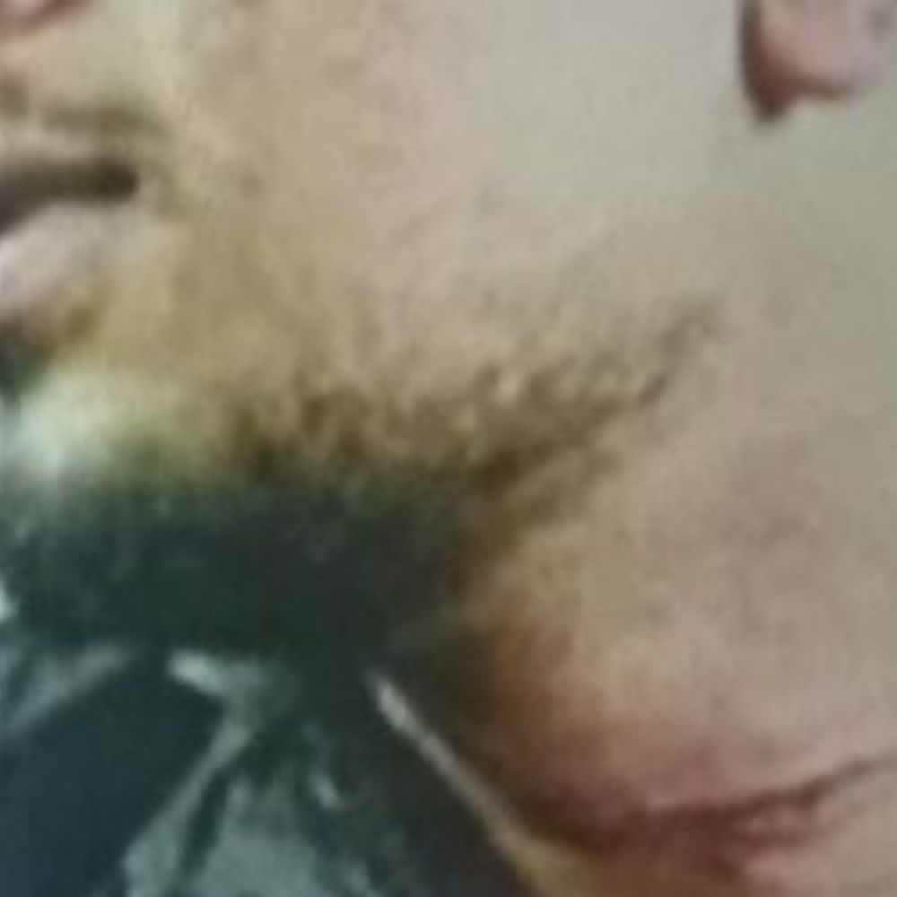 मेरठ में मांझे से गर्दन, अंगुली कटी:  बसंत पंचमी पर चाइनीज मांझे से हादसा – Meerut News