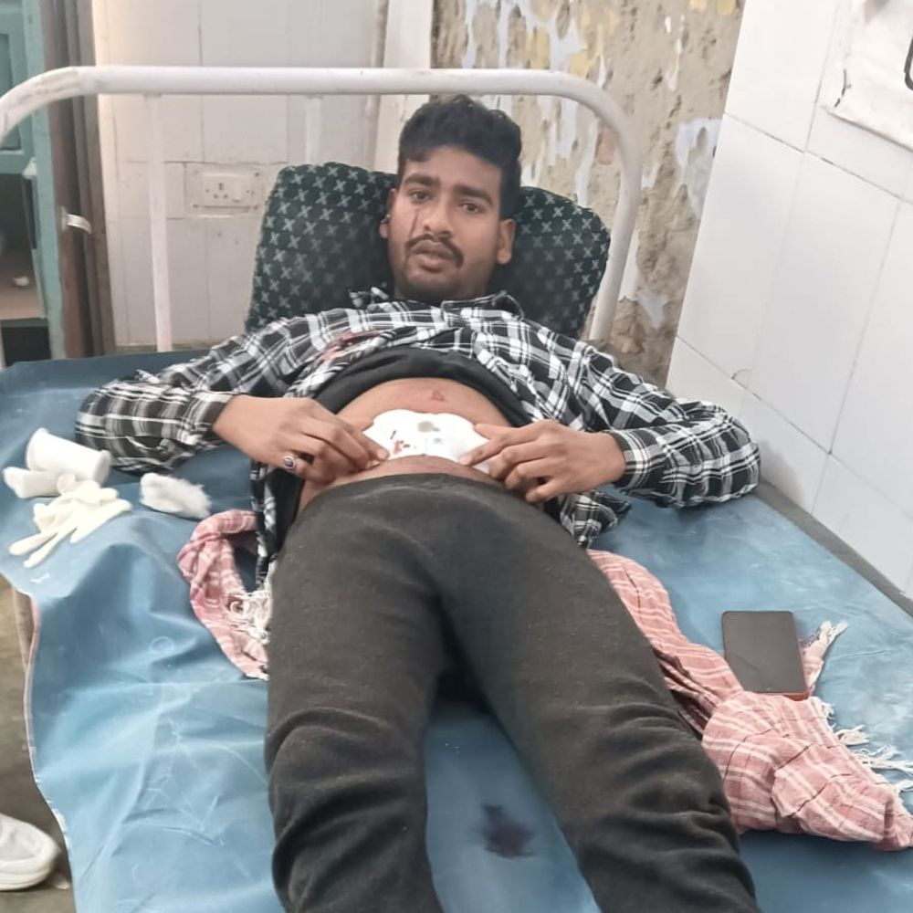 72 घंटे बाद भी खाली हाथ पुलिस:  अम्बेडकरनगर में शराब ठेके पर लूट के बाद गोली खाकर जिंदगी से जूझ रहा सेल्समैन – Ambedkarnagar News