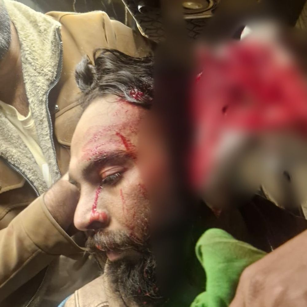पचमढ़ी में टूर एडवेंचर कंपनी और टूरिस्ट में विवाद:  इंदौर के सॉफ्टवेयर इंजीनियर के सिर पर हमला; ऑनर बोला- मुझसे मारपीट की – narmadapuram (hoshangabad) News