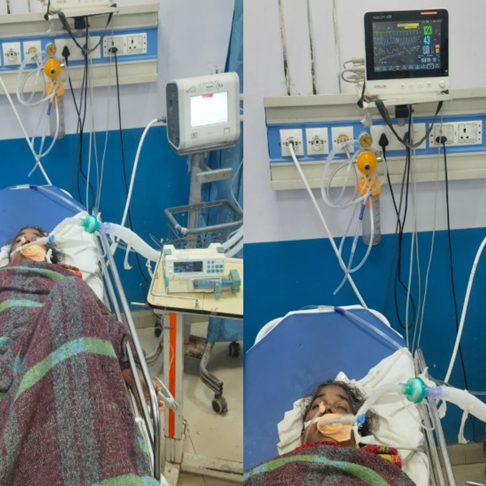 रायपुर में आंदोलन के दौरान 2 महिला रसोइयों की मौत:  यूनियन बोला- घटना के बाद भी लंबित मांगों पर कोई निर्णय नहीं लिया गया – Raipur News