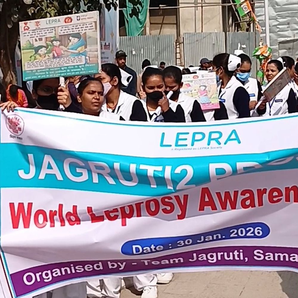 समस्तीपुर में विश्व कुष्ठ जागरूकता दिवस पर कार्यक्रम:सदर अस्पताल की नर्स ने निकाली जागरूकता रैली, कहा- इलाज संभव है