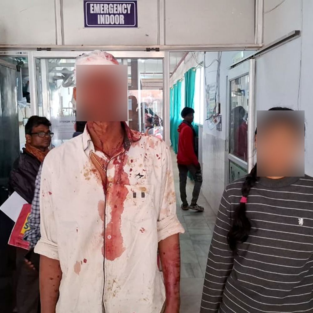 युवती से छेड़खानी का विरोध, भाई की बेरहमी से पिटाई:  सिर पर गंभीर चोट, अस्पताल में भर्ती कराया गया; पुलिस जांच में जुटी – Dhanbad News