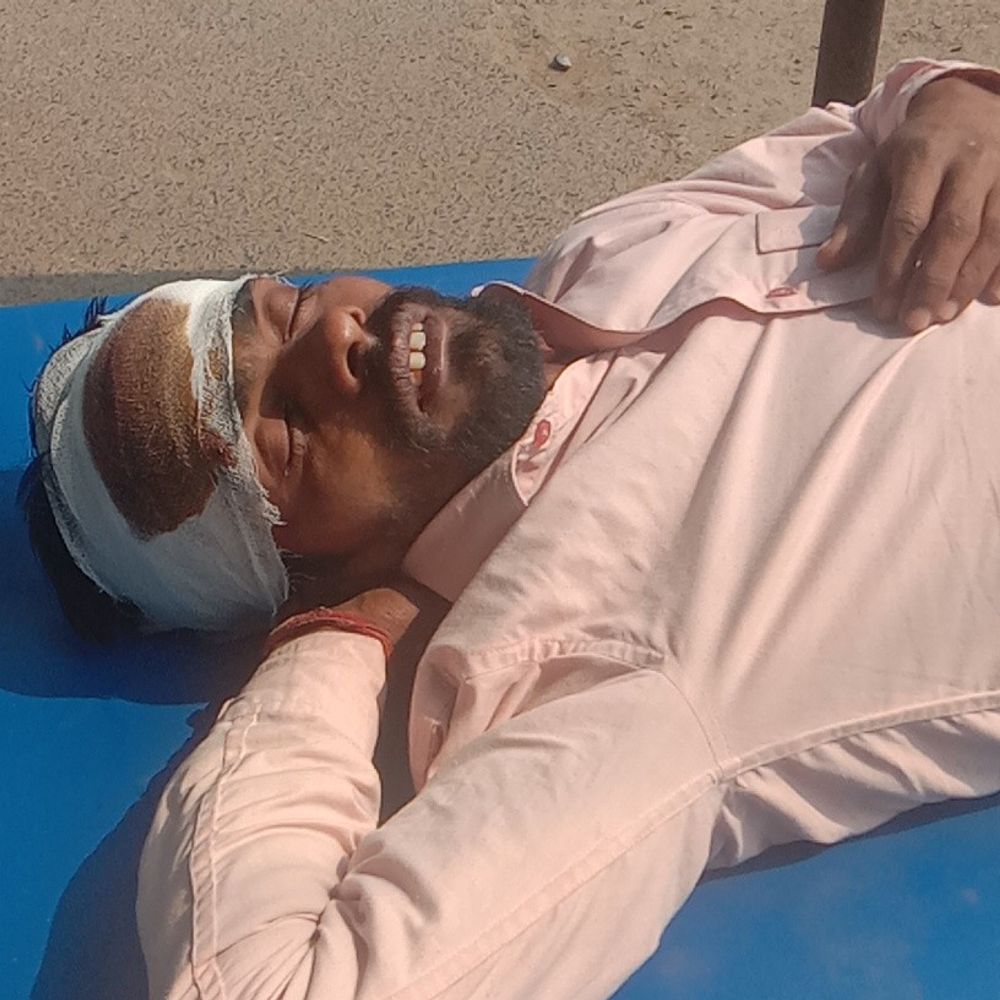 भागलपुर में ऑटो पलटा, 2 महिला समेत 5 घायल:सुल्तानगंज से भागलपुर की ओर जा रहे थे सभी, बीच सड़क बच्चे के आने से हादसा