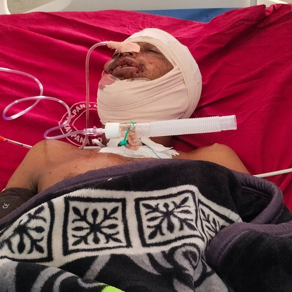 बेगूसराय में किसान के मुंह में मारी गोली:बुलेट से कटी जीभ, पड़ोसी से चल रहा था जमीन विवाद; कहासुनी के बाद फायरिंग