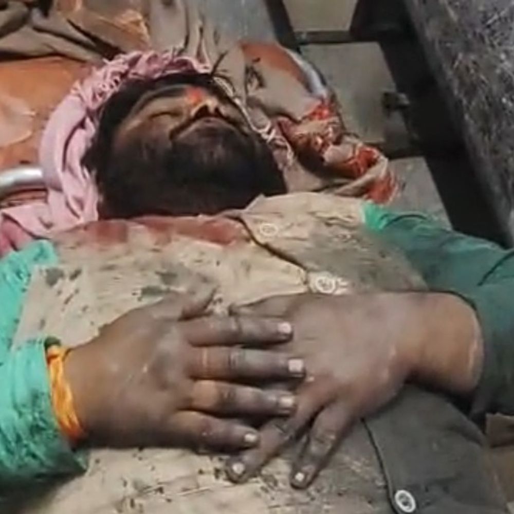 कौशांबी में भाजपा नेता पर जानलेवा हमला:जमीन विवाद में घायल, जिला अस्पताल में भर्ती