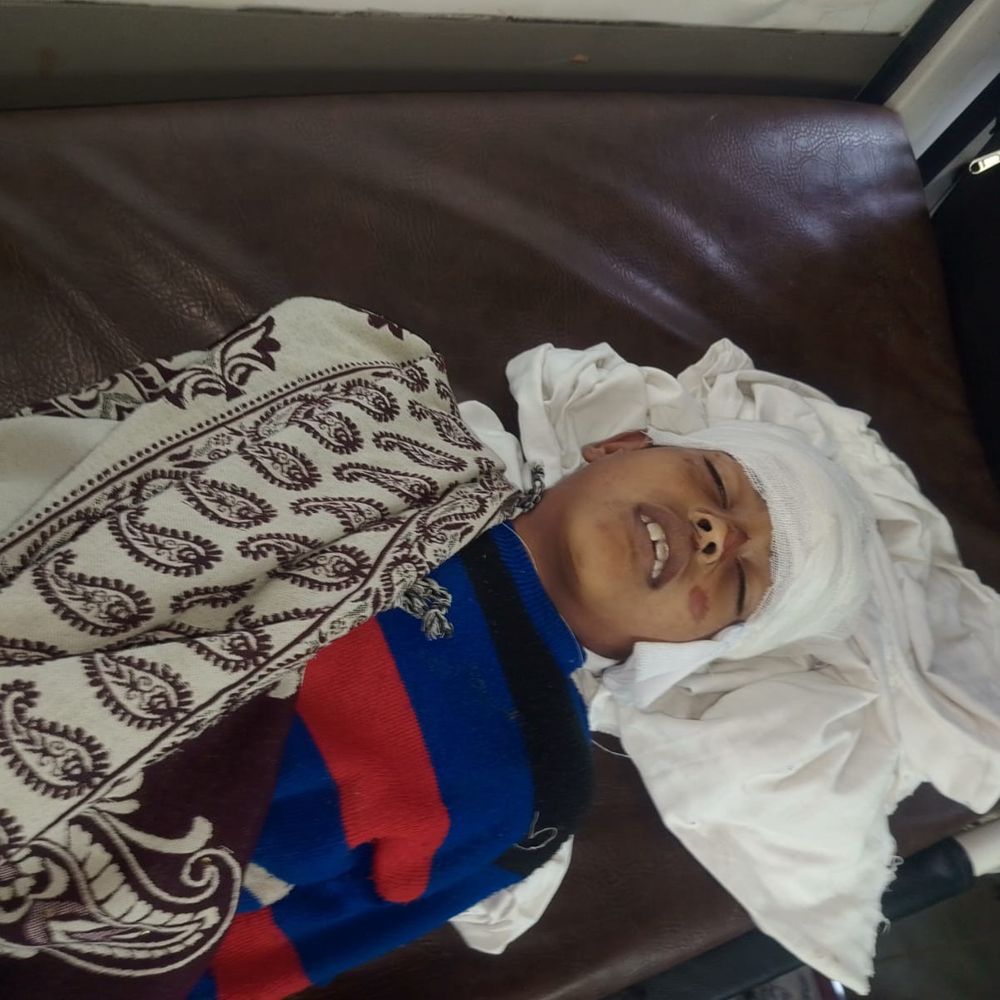 मथुरा में शादी समारोह के दौरान हादसा:तेज रफ्तार बाइक ने बच्चे को रौंदा, मौत; खुशियां मातम में बदली