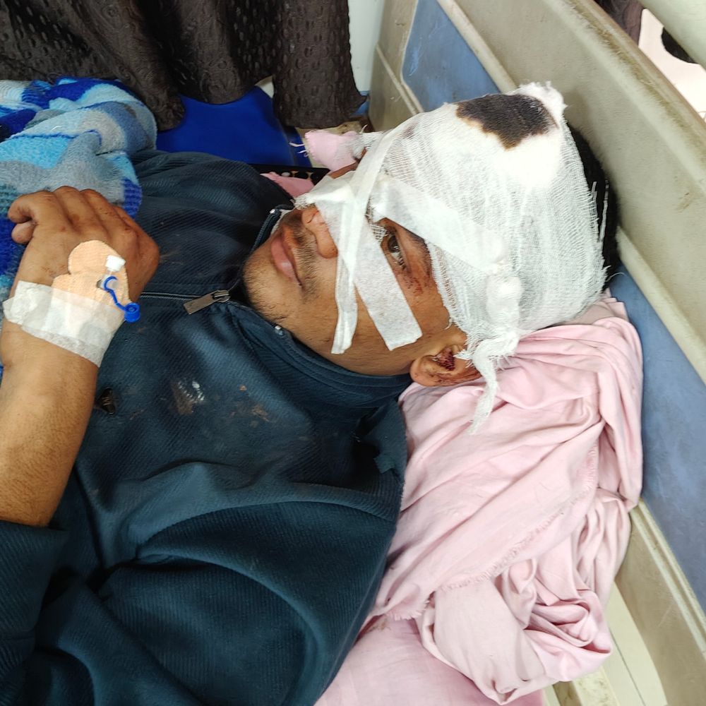 हाथरस में कार-बाइक भिड़ंत में तीन युवक गंभीर घायल:कार का टायर फटने से हुआ हादसा, शादी समारोह से घर लौटते समय हादसा