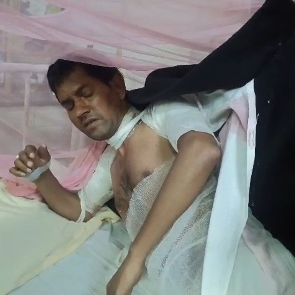 लोको पायलट को जिंदा जलाने का आरोप:उन्नाव में पत्नी, सास और दो साले नामजद; गंभीर घायल