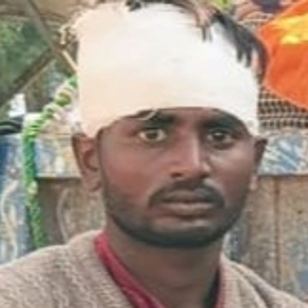 सर्विस लेन पर आराम कर रहे कांवड़ियों को कार ने:पांच कावड़िए घायल, तिवारीगंज मोड़ के पास की घटना