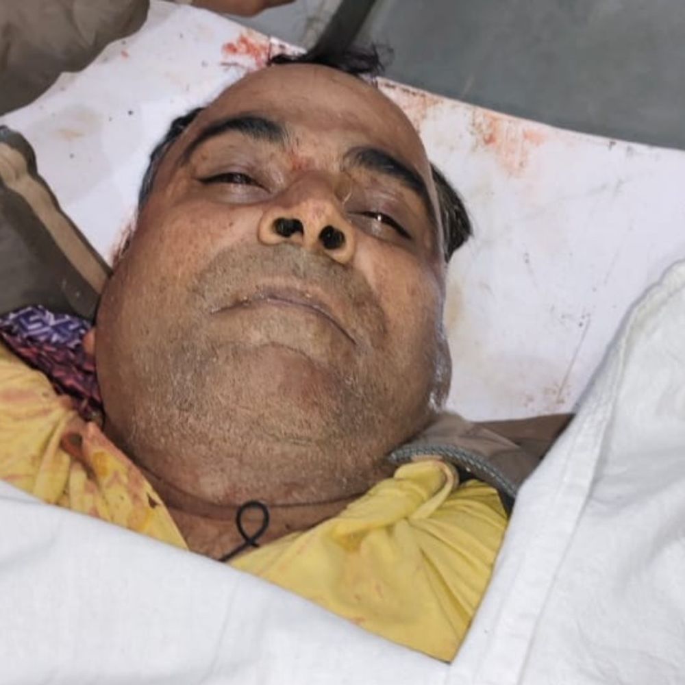 मुजफ्फरनगर में एक लाख का इनामी अमजद ढेर:SP देहात समेत 4 पुलिसकर्मी घायल, 40 केस दर्ज थे