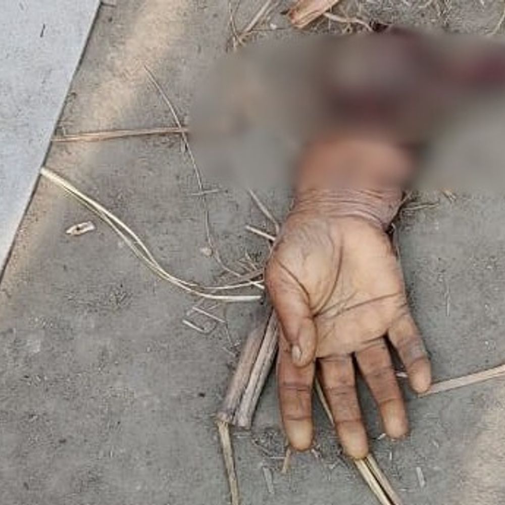 सड़क-हादसे में महिला की हाथ कटकर 20 मीटर दूर गिरा:कुशीनगर के पिपरा कनक में हुआ हादसा, मौके पर हुई बेहोश