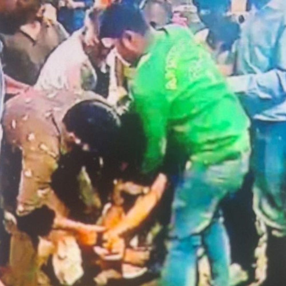 ढाबा पर दो पक्षों में मारपीट, 2 राउंड फायरिंग हुई:आगरा में गोली लगने से ढाबा मालिक घायल, फिर भी हिम्मत दिखाते हुए आरोपी को पकड़ा