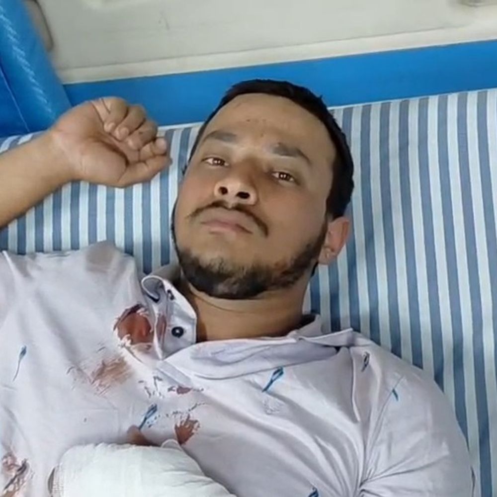 बागपत के हमीदाबाद हाईवे पर नीलगाय से टकराई बाइक:तीन युवक गंभीर रूप से घायल, अस्पताल में भर्ती