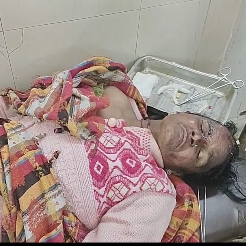 बुजुर्ग महिला पर धारदार हथियार से हमला:बहराइच में खेत में मवेशी जाने को लेकर हुआ था विवाद, सिर पर गंभीर चोट