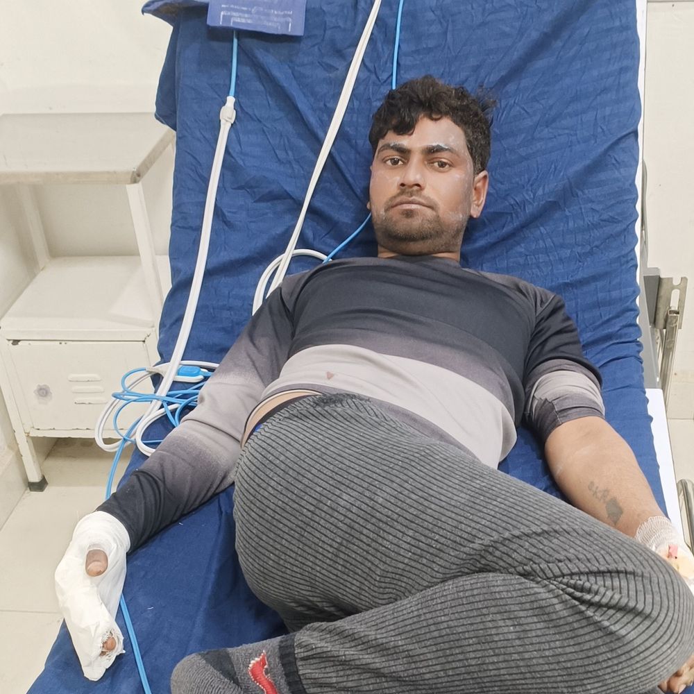 झिंझाना थाने में शराब नष्ट करते समय हादसा:दो पुलिसकर्मी और दो चौकीदार झुलसे, एक की हालत गंभीर