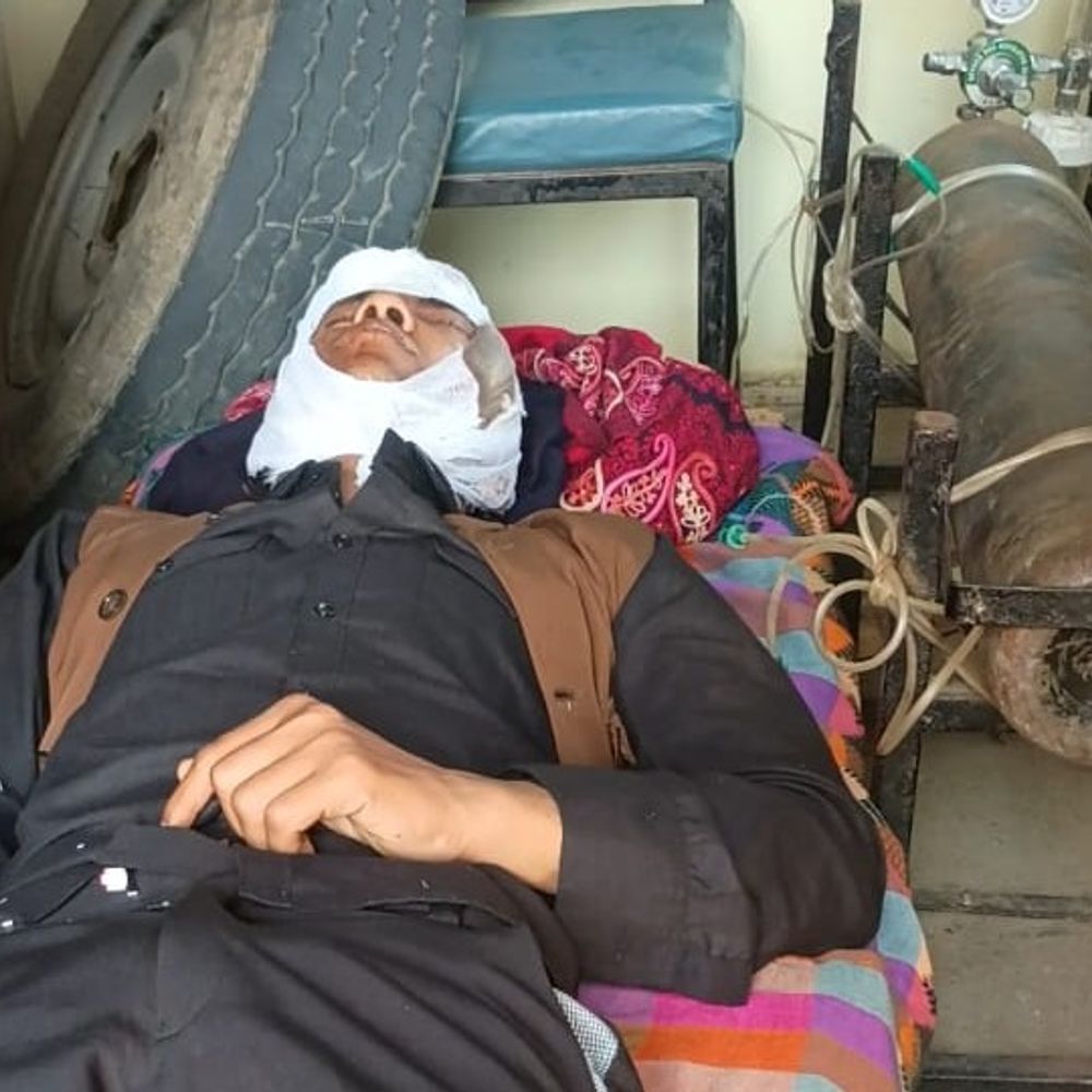 तिलक समारोह जा रहे दो दोस्तों पर हमला:एक गंभीर रूप से घायल, गोरखपुर रेफर