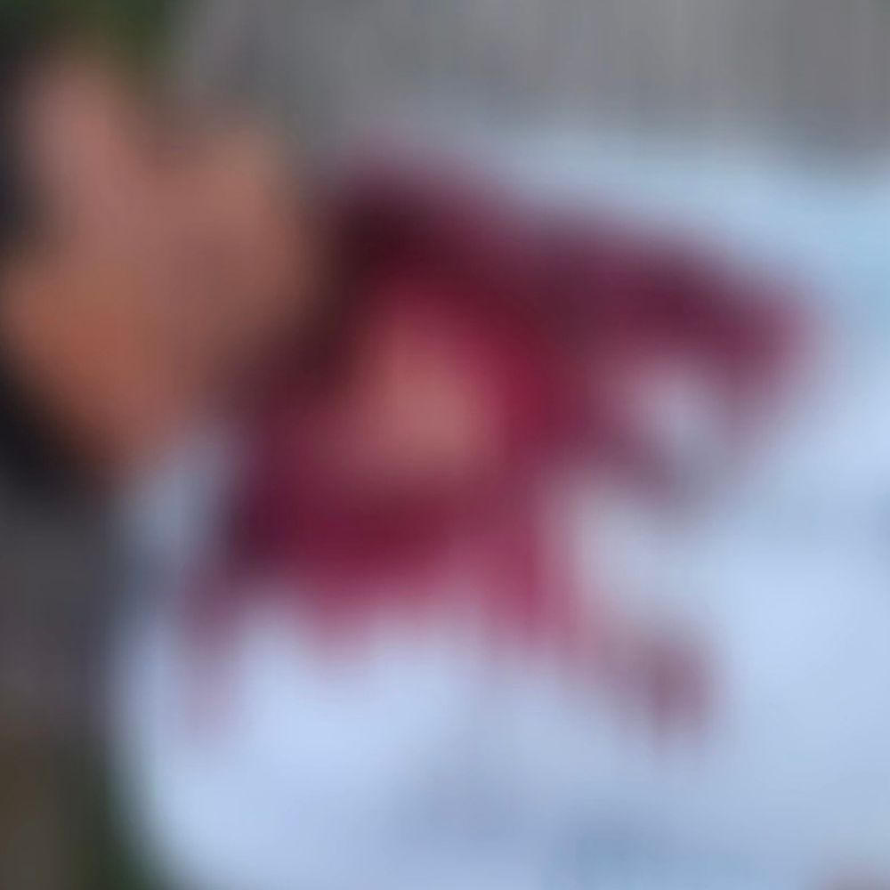 अलीगढ़ में ट्यूबवेल पर मिला युवक का शव:गले पर चोट के निशान, परिजनों ने हत्या का आरोप लगाया