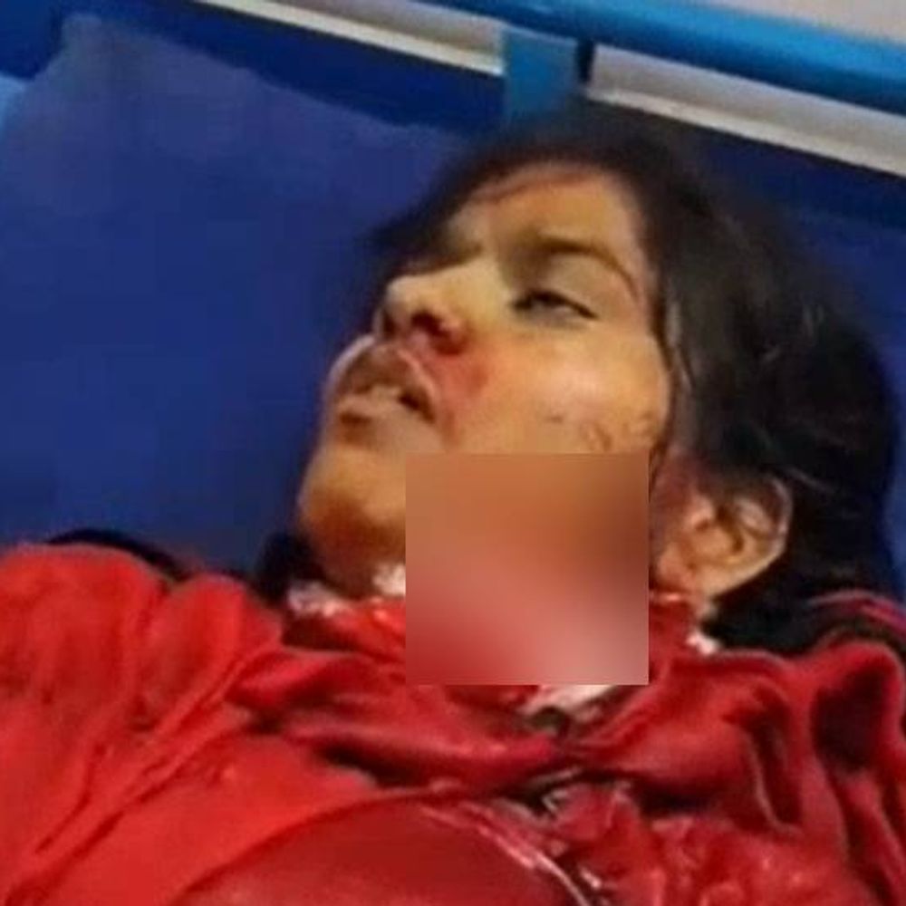 बहन ने शादी से रिजेक्ट किया ...भाभी को मार डाला:मथुरा में खुद का गला काटकर की जान देने की कोशिश, 4 महीने पहले हुई थी मैरिज