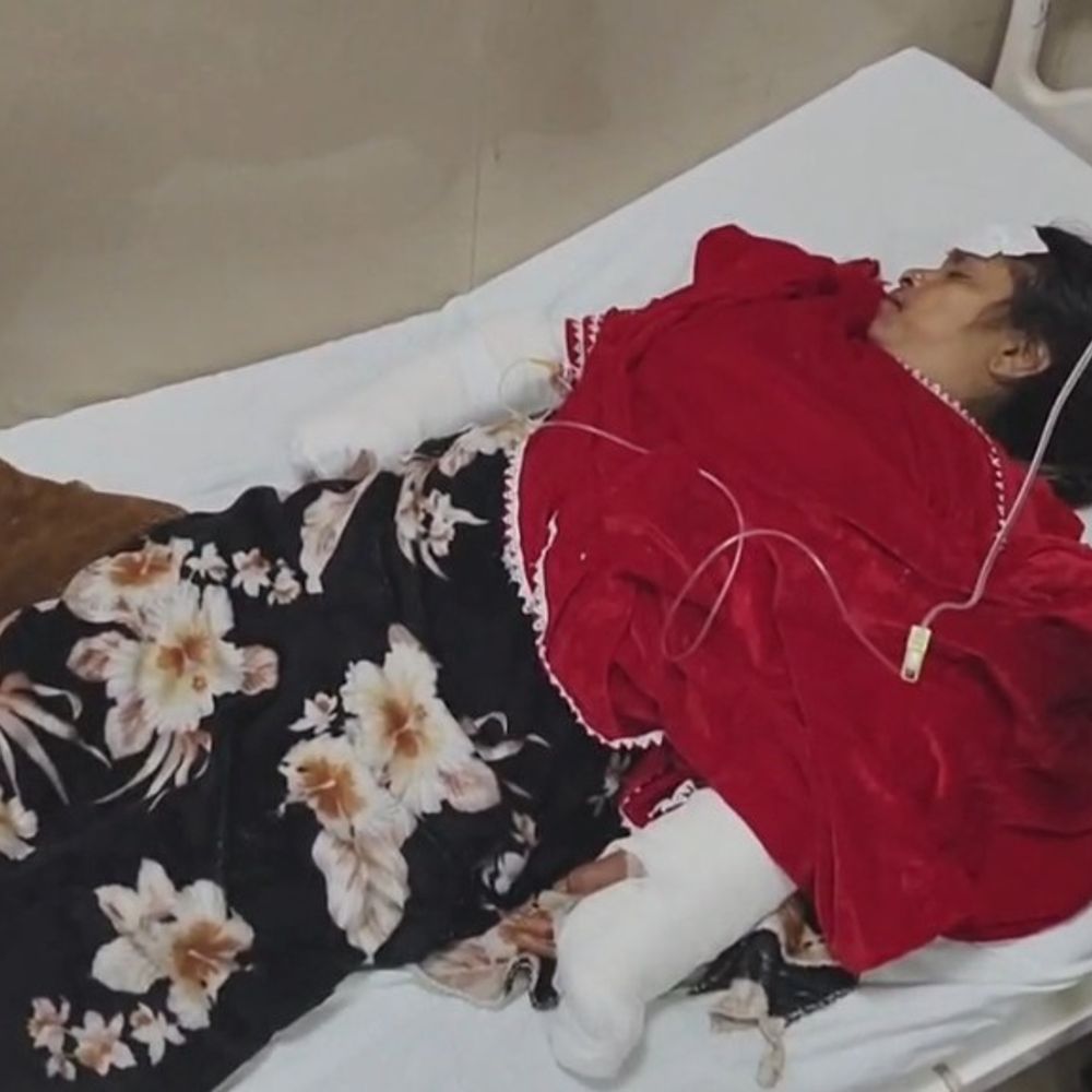 बहराइच में महिला पर बंदरों ने किया हमला:बचने के दौरान छत से गिरी, दोनो हाथ टूटे, सिर पर भी चोट