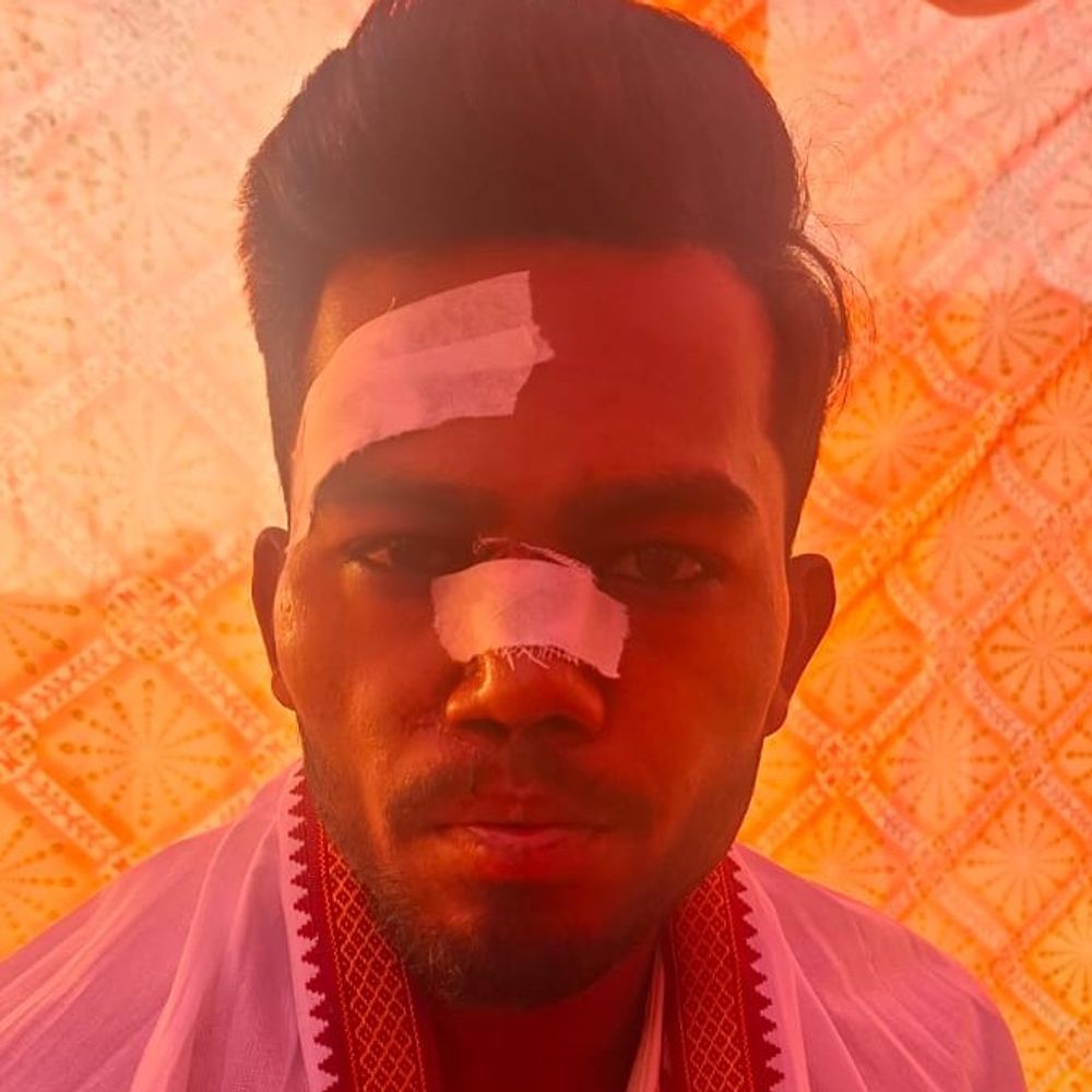 संभल में द्वारचार के दौरान दीवार गिरी:दूल्हा-बाराती घायल, बच्चे का पैर टूटा, 3 घंटे रुकी शादी की रस्म