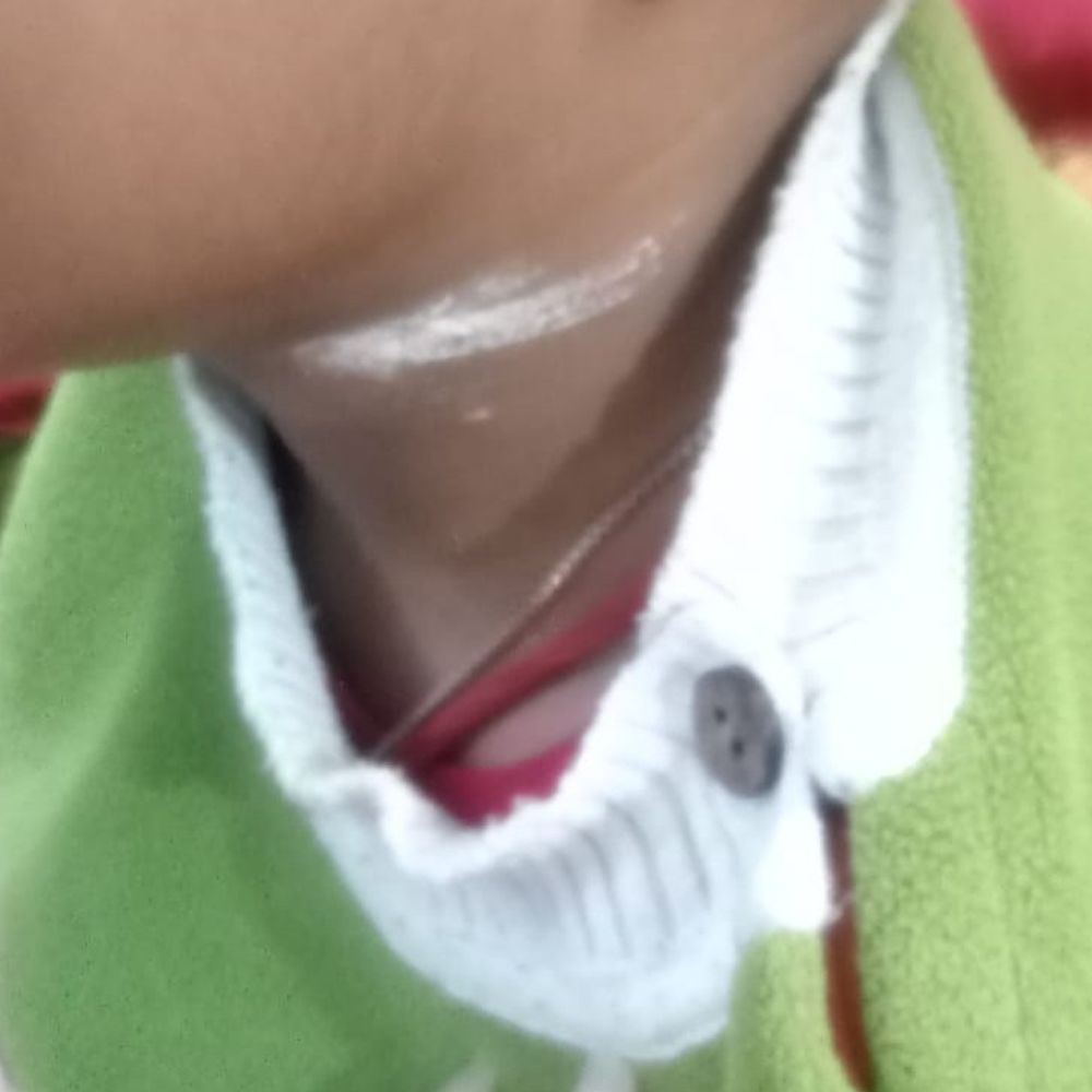 चाइनीज मंझे से दो साल के मासूम का गला कटा:प्रयागराज में ‘मौत का मांझा’ फिर बना खतरा, ताऊ के साथ जा रहा था तभी रास्ते में हुआ हादसा