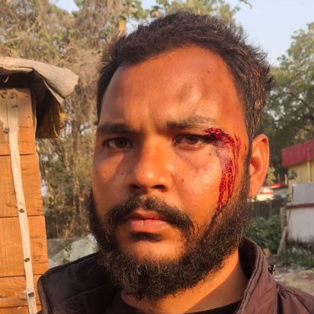 विदेश राज्यमंत्री का निजी सचिव बताकर मारपीट की:रमन यादव समेत चार पर मुकदमा दर्ज, जांच में जुटी पुलिस