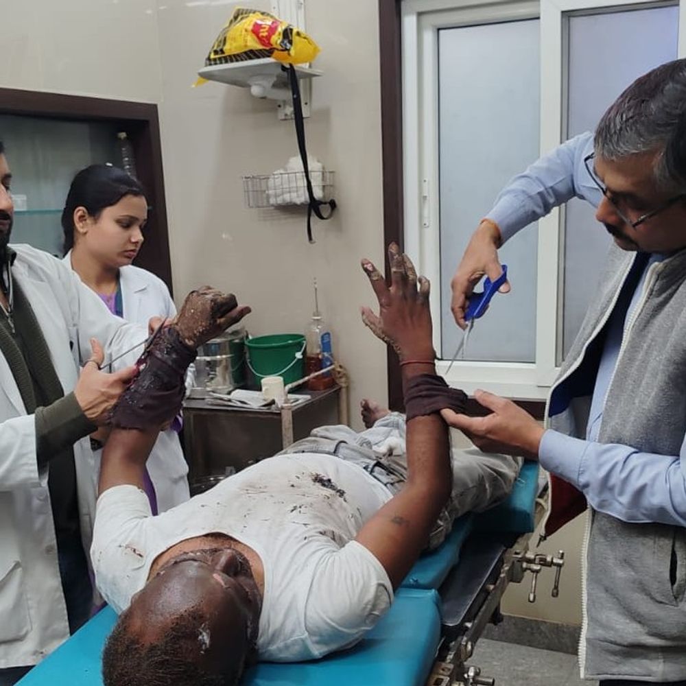 लखनऊ में करंट से झुलसा बिजली कर्मचारी:हालत नाजुक; फीडर में धमाके के बाद चपेट में आया, लापरवाही से हादसा हुआ