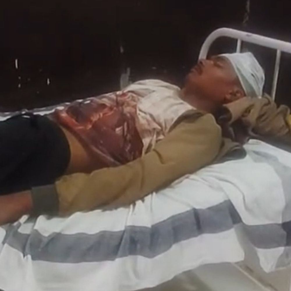 सिवनी में अनियंत्रित होकर बाइक फिसली:2 घायल, एक जबलपुर रेफर; सरगांव के पास हादसा