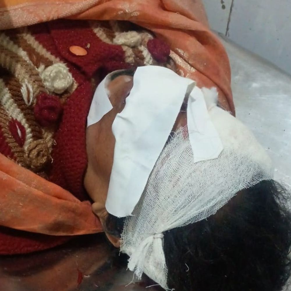 देवरिया में पंचायत सेक्रेटरी और किशोरी सड़क हादसे में घायल:ड्यूटी से लौटते समय तेज रफ्तार बाइक ने मारी टक्कर, मेडिकल कॉलेज रेफर