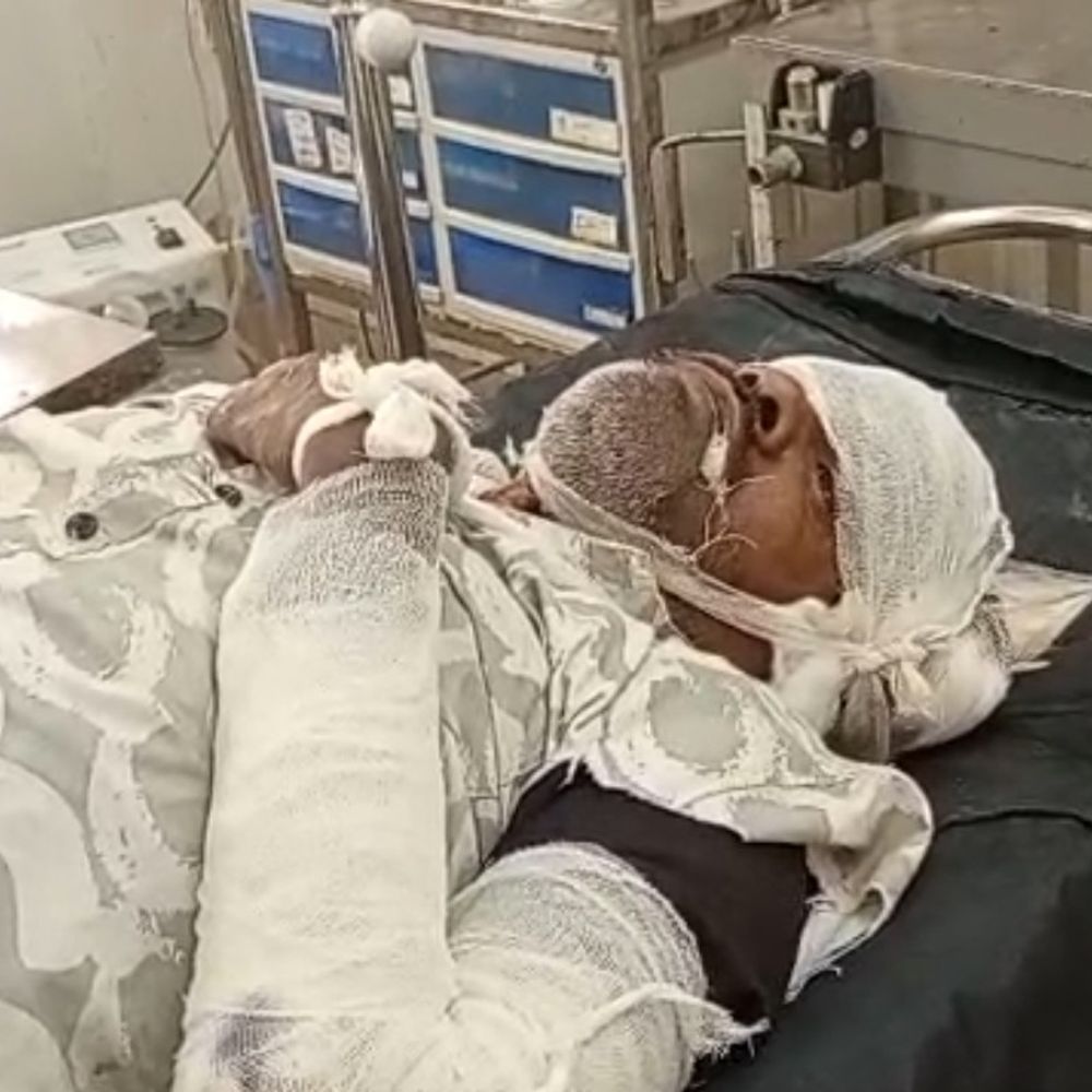 देवरिया में स्टेशन के पास ट्रेन से गिरा यात्री:गंभीर हालत में गोरखपुर रेफर, गुजरात से अपने घर लौट रहे थे