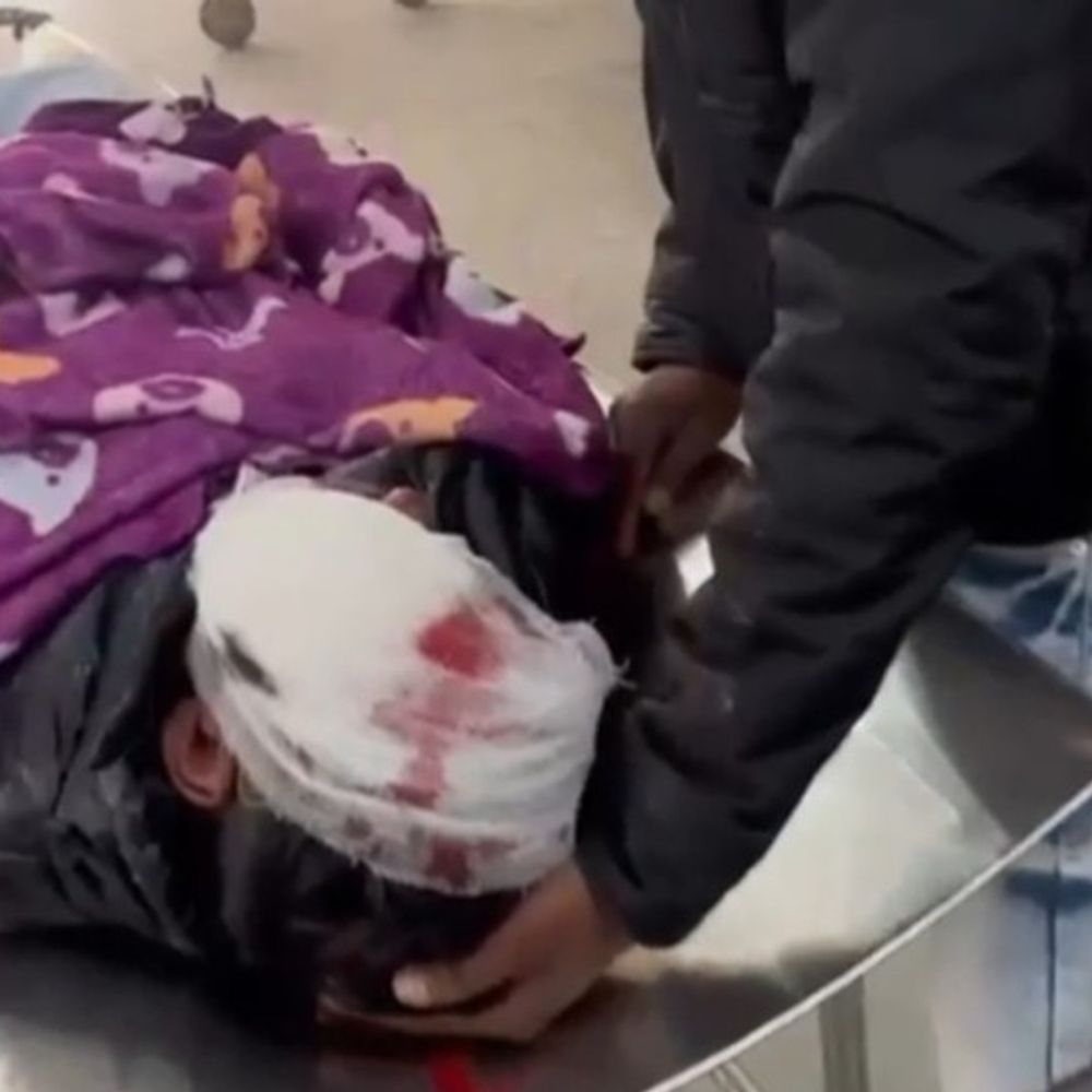 पिकअप की टक्कर से 10वीं के 3 छात्र गंभीर घायल:देवरिया के रुद्रपुर में बोर्ड परीक्षा देने जा रहे थे, गोरखपुर मेडिकल कॉलेज रेफर